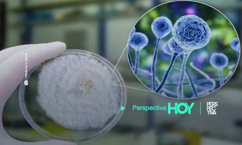 Muere primer paciente de «hongo negro» en Hospital General