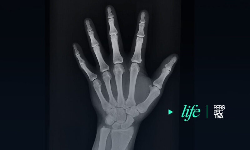osteoporosis, enfermedad silenciosa